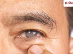 पार्लर में मसाज के दौरान ये गलती आंखों पर पड़ेगी भारी,आई डॉक्टर ने शेयर किया केस