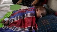 বিশেষ ক্যাম্পেইনে হামের টিকা ৬ মাস বয়সে, আগে হলে করণীয় কী? আরাে যত প্রশ্ন