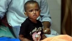 বাংলাদেশের হাসপাতালে আইসিইউ এবং ভেন্টিলেশন সেবা কতটা আছে, কী পরিস্থিতি?