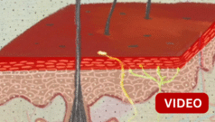 காணொளி: மனஅழுத்தத்தால் முகப்பரு ஏற்படுமா?