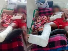 വീട്ടുമുറ്റത്ത് കളിക്കുന്നതിനിടെ കാട്ടുപന്നിയുടെ ആക്രമണം; ആറാം ക്ലാസുകാരന് ഗുരുതര പരുക്ക്